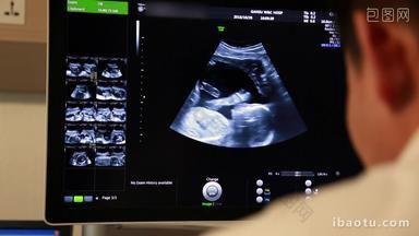 孕妇怀孕期间的b超检查